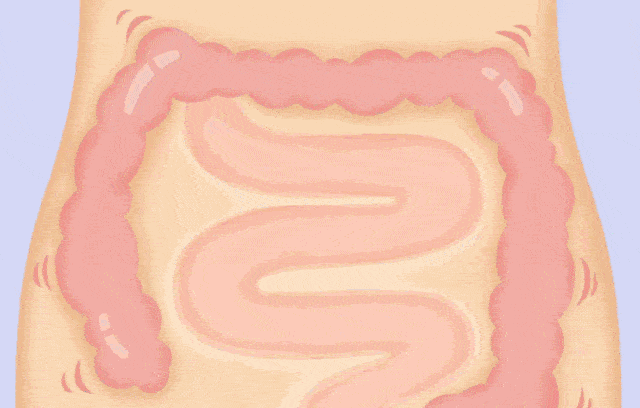 1762446720713712.gif 1762446720713712.gif